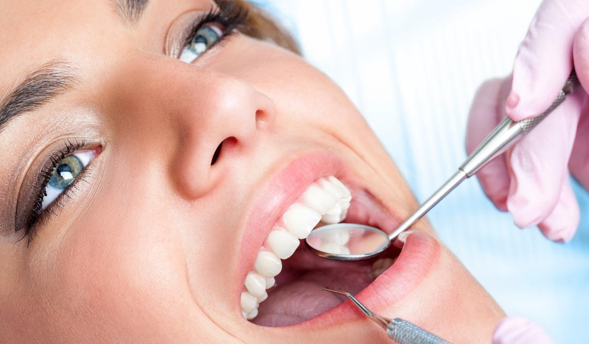 Blanqueamiento Dental